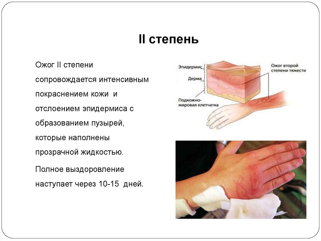 Что будет если сжечь фотографию живого